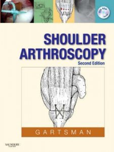 Shoulder Arthroscopy
