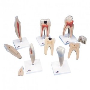 Serie di denti 3B Scientific®, 5 modelli
