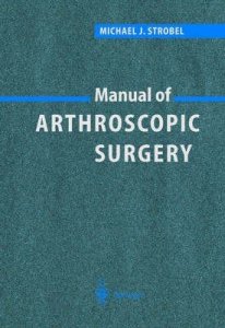 Manual of Arthroscopic Surgery
