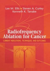 Radiofrequency Ablation for Cancer