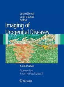 Imaging of Urogenital Diseases
