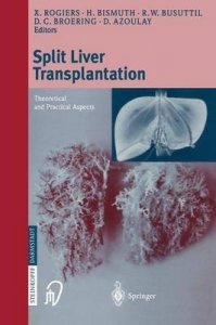 Split Liver Transplantation