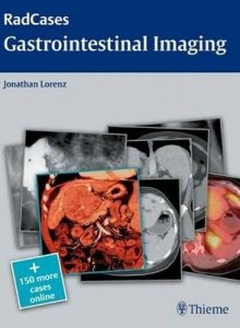 Gastrointestinal Imaging: RadCases