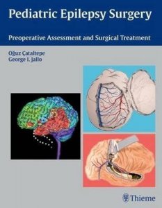 Pediatric Epilepsy Surgery Preoperative Assesment and Surgical Treatment