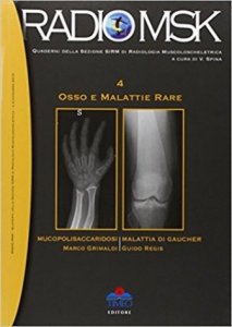 osso e malattie rare Mucopolisaccaridosi - Malattia di Gaucher
