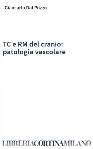 TC e RM del cranio: patologia vascolare