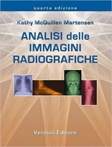 Analisi delle immagini radiografiche