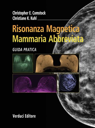 Risonanza magnetica mammaria abbreviata. Guida pratica