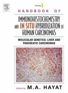 Handbook of Immunohistochemistry and in Situ Hybridization of Human Carcinomas