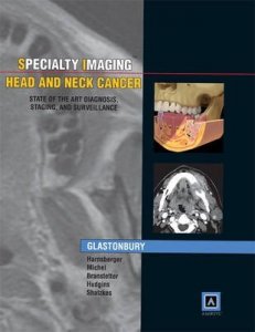 Specialty Imaging: Head & Neck Cancer