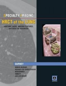 Specialty Imaging: HRCT of the Lung
