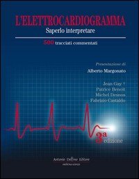 Elettrocardiogramma saperlo interpretare