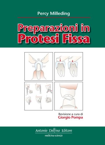 Preparazioni in protesi fissa
