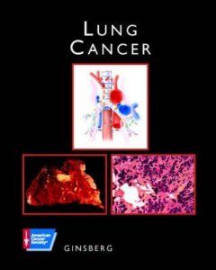 Lung Cancer