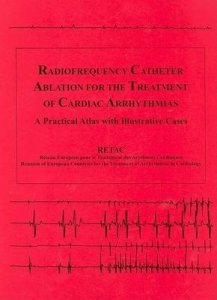 Radiofrequency Catheter Ablation