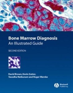 Bone Marrow Diagnosis