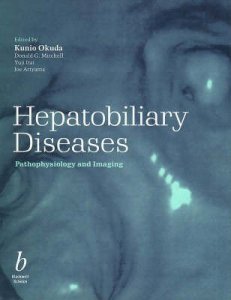 Hepatobiliary Diseases