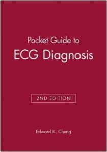 Pocket Guide to ECG Diagnosis