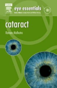 Cataract