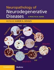Neuropathology of Neurogenerative Diseases