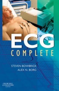 ECG Complete
