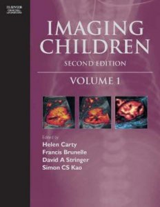 Imaging Children
