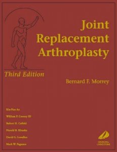 Joint Replacement Arthroplasty
