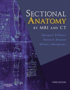 Sectional Anatomy by MRI and CT
