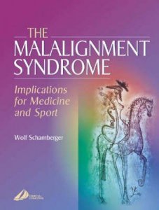 The Malalignment Syndrome
