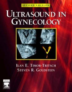 Ultrasound in Gynecology