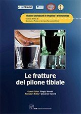 fratture del pilone tibiale