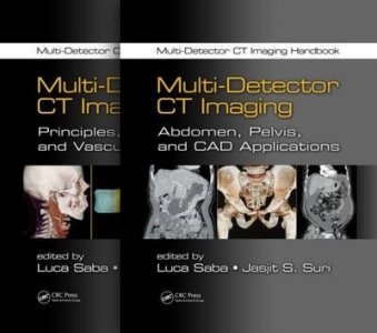 Multi-Detector CT Imaging Handbook