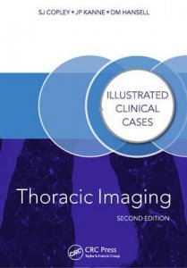 Thoracic Imaging