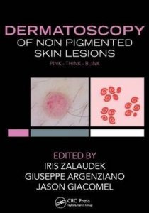 Dermatoscopy of Non-Pigmented Skin Tumors
