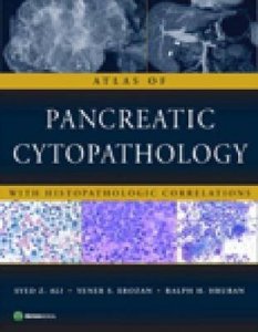 Atlas of Pancreatic Cytopathology with Histopathologic Correlations
