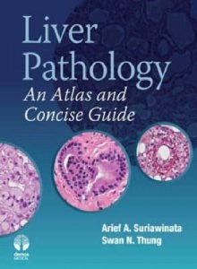 Liver Pathology