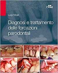 Diagnosi e trattamento delle forcazioni parodontali