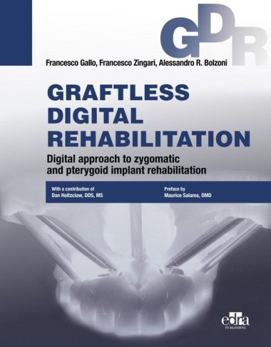 Graftless digital rehabilitation, gdr. Digital approach to zygomatic and pterygoid implant rehabilitation EDIZIONE IN INGLESE