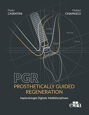 PGR. Prosthetically guided regeneration. Implantologia Digitale Multidisciplinare