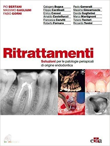 Ritrattamenti. Soluzioni per le patologie periapicali di origine endodontica
