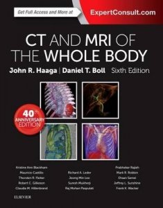 CT and MRI of the Whole Body