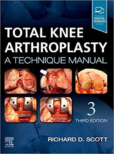 Total Knee Arthroplasty