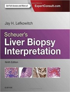 Scheuer's Liver Biopsy Interpretation