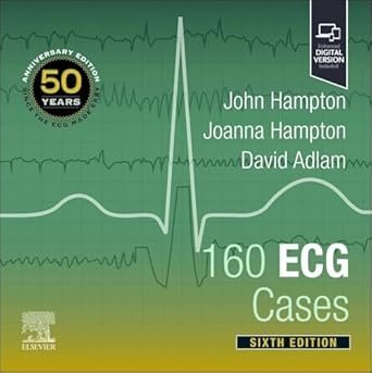 160 ECG Cases