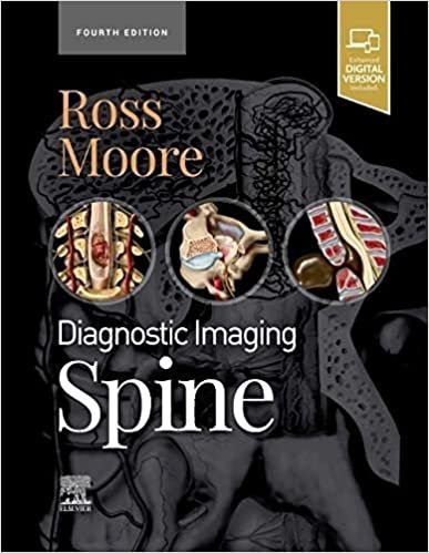 Diagnostic Imaging: Spine