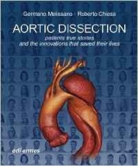 Aortic Dissection