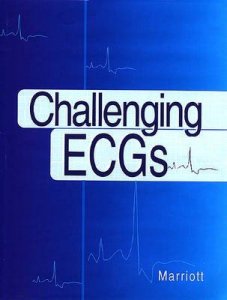 Challenging ECGs