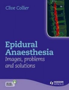 Epidural Anaesthesia Images, Problems and Solutions