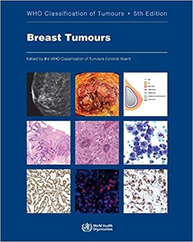 Who Classification of Tumors: Breast Tumours