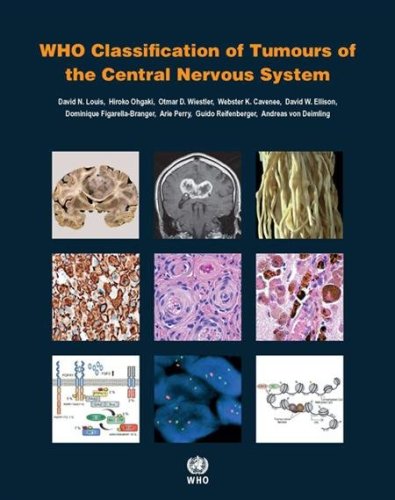 WHO Classification of the Central Nervous System